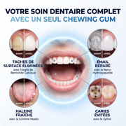 Frostee - Chewing Gum Blanchissant
