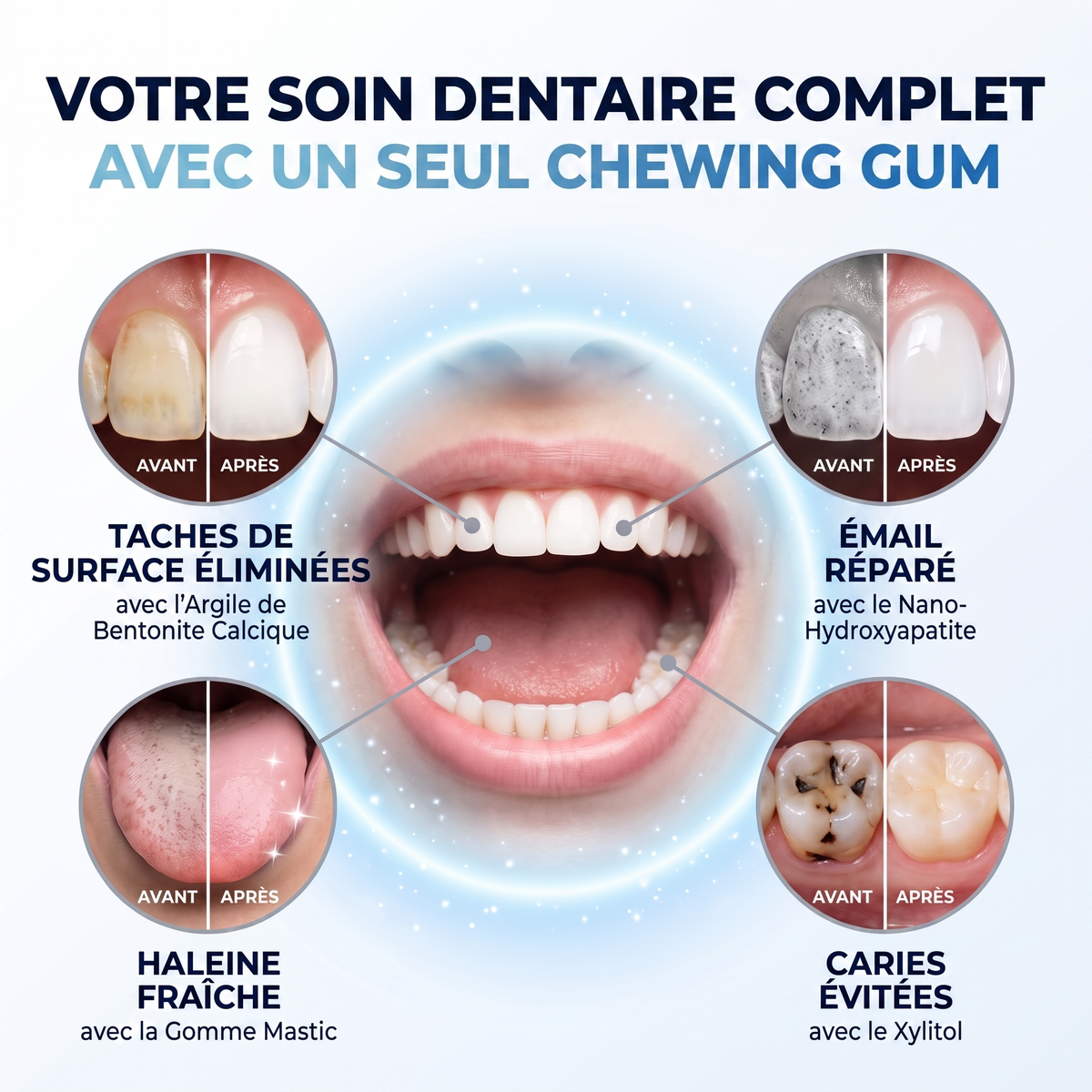 Frostee - Chewing Gum Blanchissant